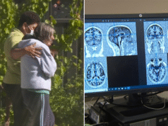 Demensia melampaui penyakit jantung sebagai penyebab kematian utama di Australia