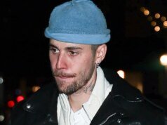 Justin Bieber Sakit Tulang Rusuk saat Skateboard Listrik Gagal