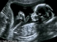 KHADIJA KHAN: Pemakai lanyard takut disebut rasis. Itu sebabnya mereka menutup mata terhadap aborsi selektif berdasarkan jenis kelamin