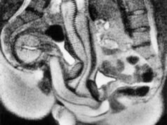 Foto unik penis di dalam vagina dicuri Natal 23 tahun lalu. Orang-orang menginginkan seks yang nyata, para ilmuwan tertawa