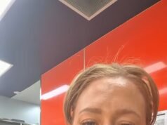 Warga Australia memicu perdebatan tentang swimwear G-string setelah pengalaman tidak nyaman: ‘Ada waktu dan tempat’