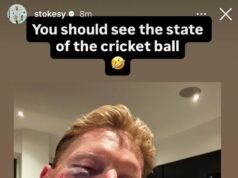 Ben Stokes menderita cedera wajah yang parah setelah terkena bola